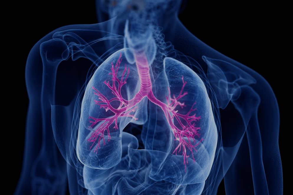 Severe Asthma, medically accurate illustration of the bronchi, Banner image