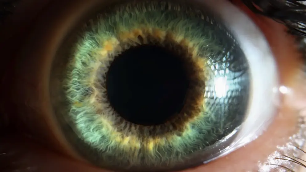 Biosimilars retinal disease teaser, eye ball