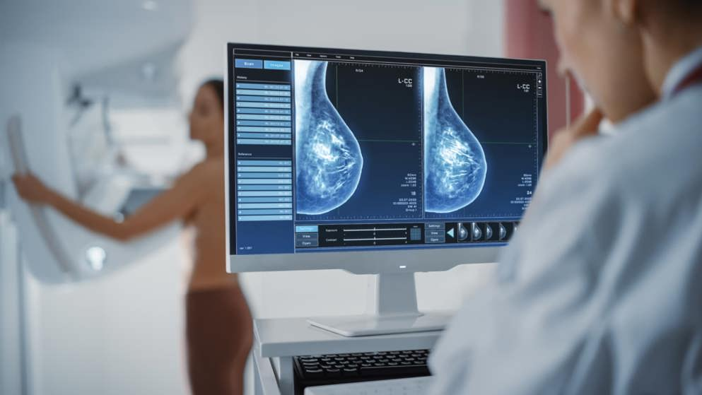 Woman having Mammogram, breast cancer screening